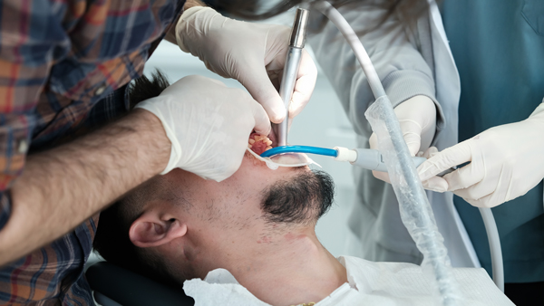 Reasons To Visit An Emergency Dentist For Tooth Extraction